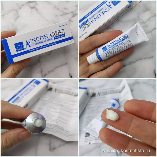 Секторальная гетерохромия радужки. Лучшие капли от синдрома сухого глаза. Взгляд другими глазами. Металлозная гетерохромия. Капает капли в глаза.