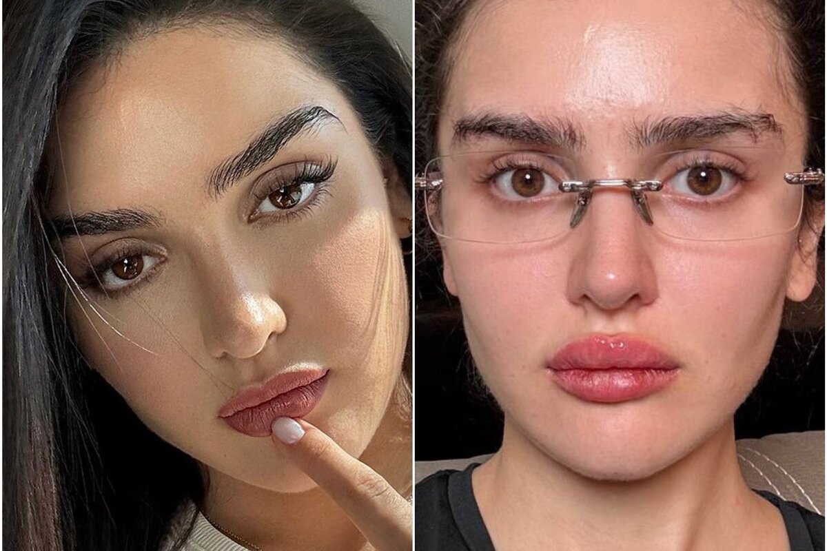 жена сделала губы. девушка с перекаченными губами. жена сделала губы. алекса певица. жена сделала губы.