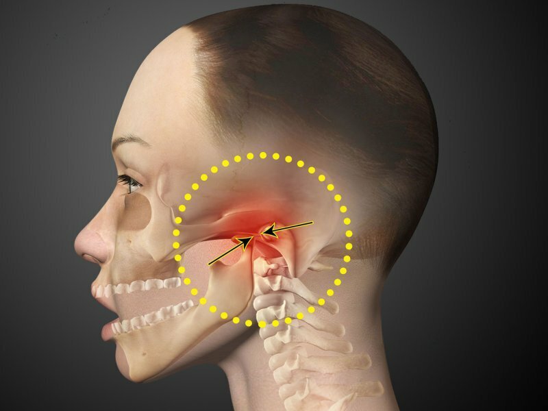 Щелчки в челюсти - причины, диагностика и лечение