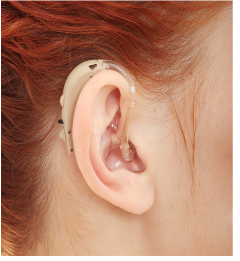 слышу вижу слуховые аппараты. слуховой аппарат человека. слышу вижу слуховые аппараты. внутриушные слуховые аппараты 20-30 канальные. потеря слуха.