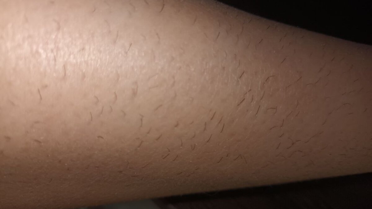 ИА SM.News Тюмень📷
