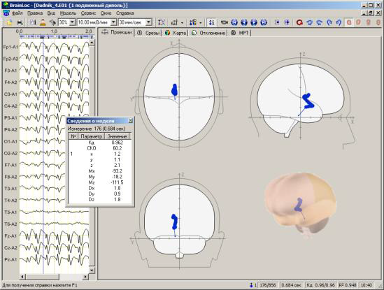 BrainLoc