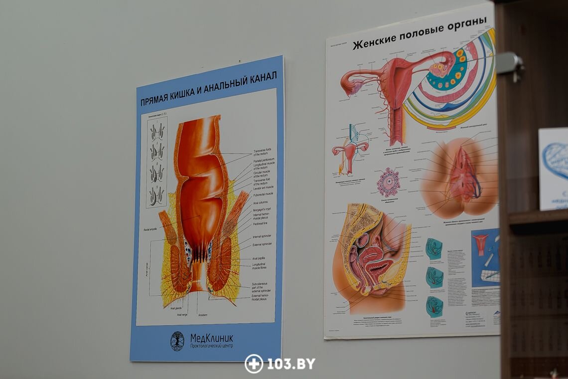 👨‍⚕️ Лазер против геморроя и трещин. Как это работает и кому подходит,  рассказывает врач-проктолог | 103.by | Дзен