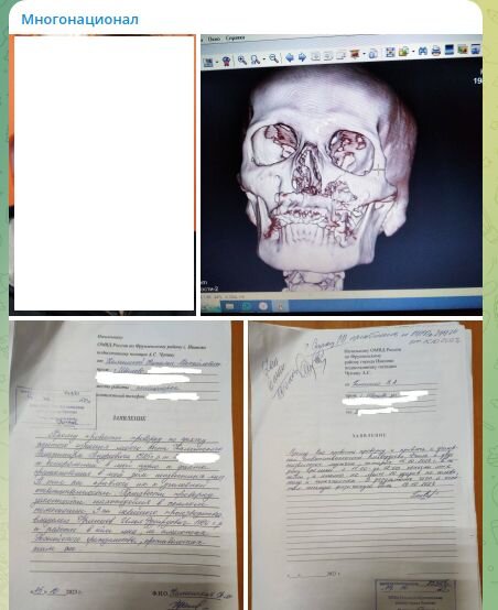 ФОТО: СКРИНШОТ T.ME/MNOGONAZI