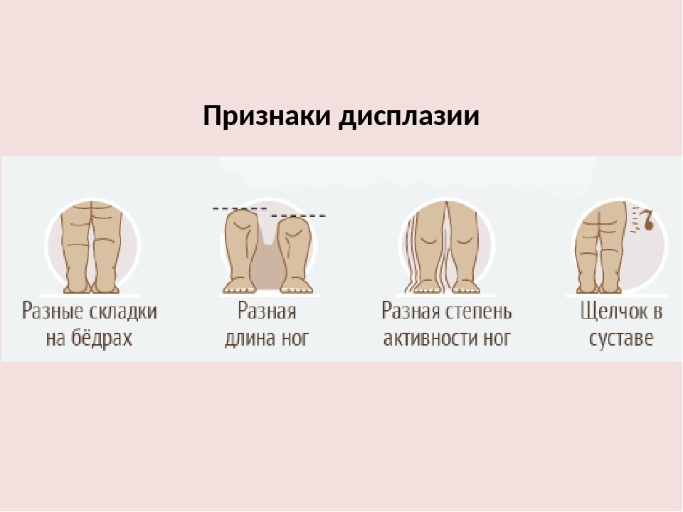 Вывих атланта (первого позвонка). Вывихом головы. Подвывих с1 шейного позвонка. Вывихом головы. Импрессионный перелом хилл-сакса плечевого.
