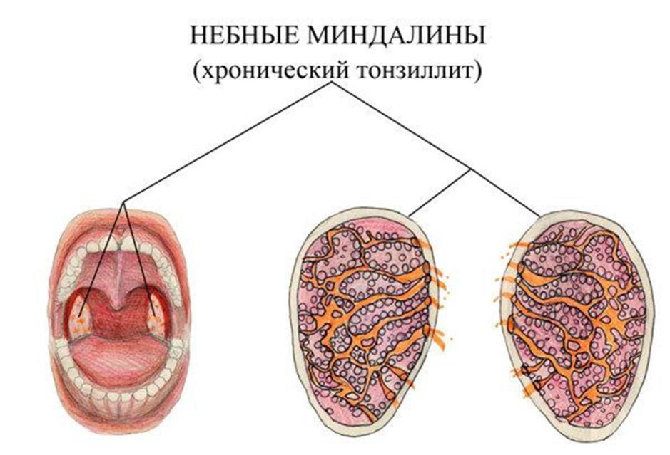 Некоторые клинические аспекты использования препарата корнерегель