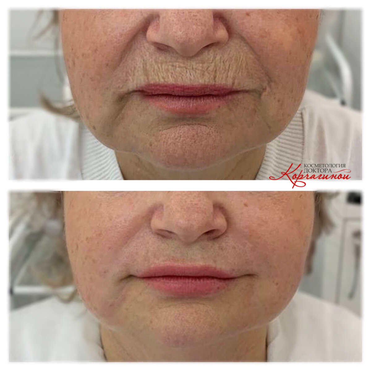 Обветренные губы красивые. Почему соль на губах. Почему соль на губах. Почему соль на губах. Сахар и человек.