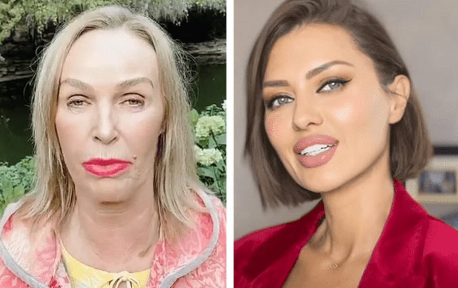    звезды операции