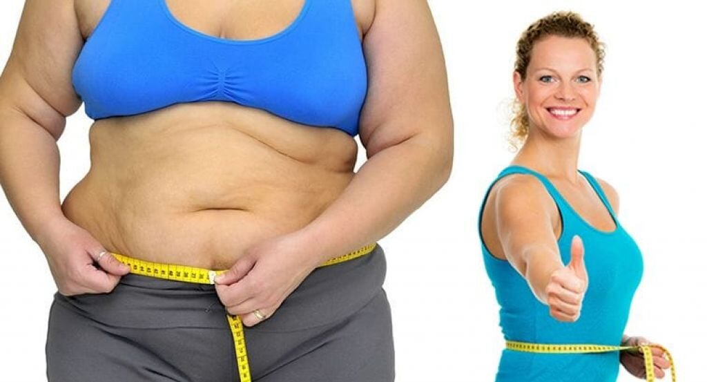 Лишний вес у женщин после 50. Обвисший живот после похудения.