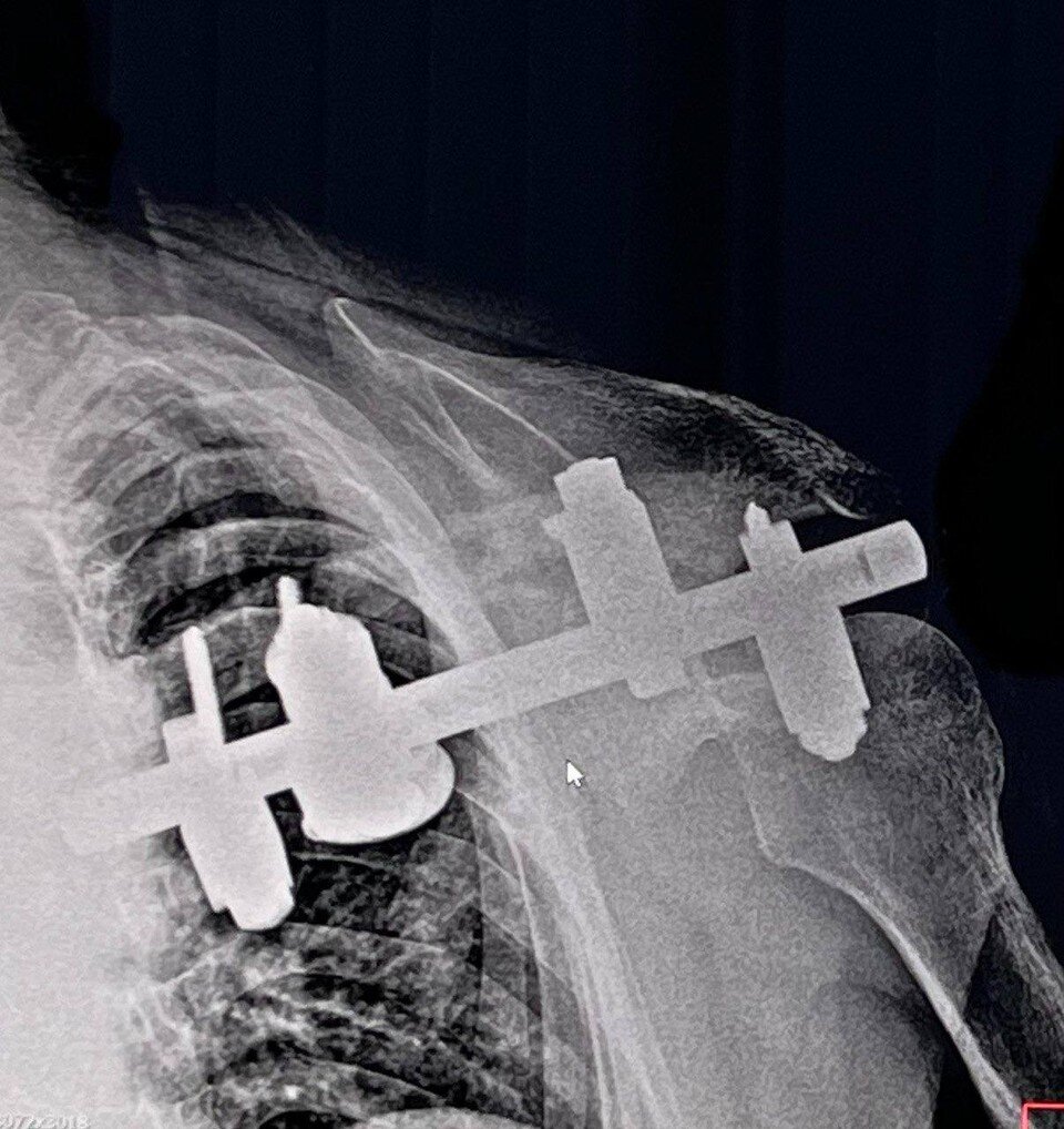 спас от заражения.