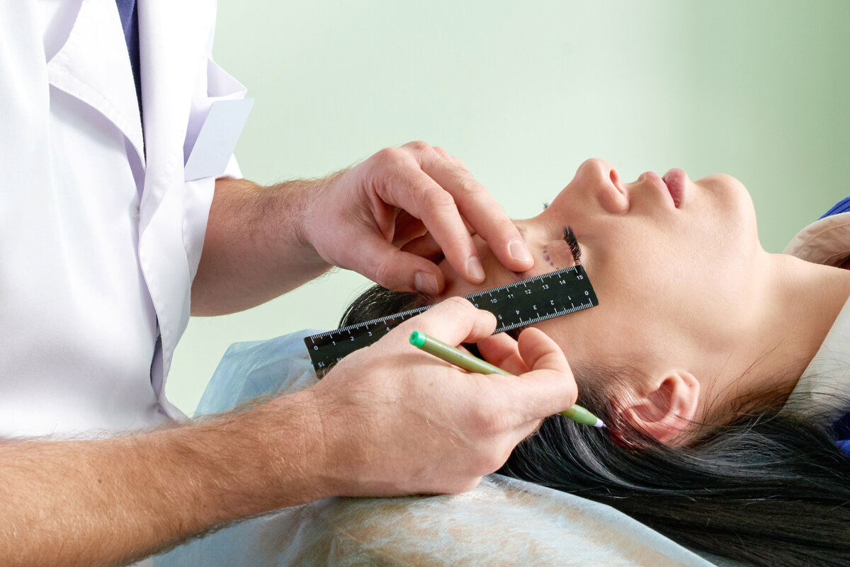 пластика кончика носа. деформация кончика носа. эстет пластическая хирургия. махачкала estet plastic. эстет пластическая хирургия.