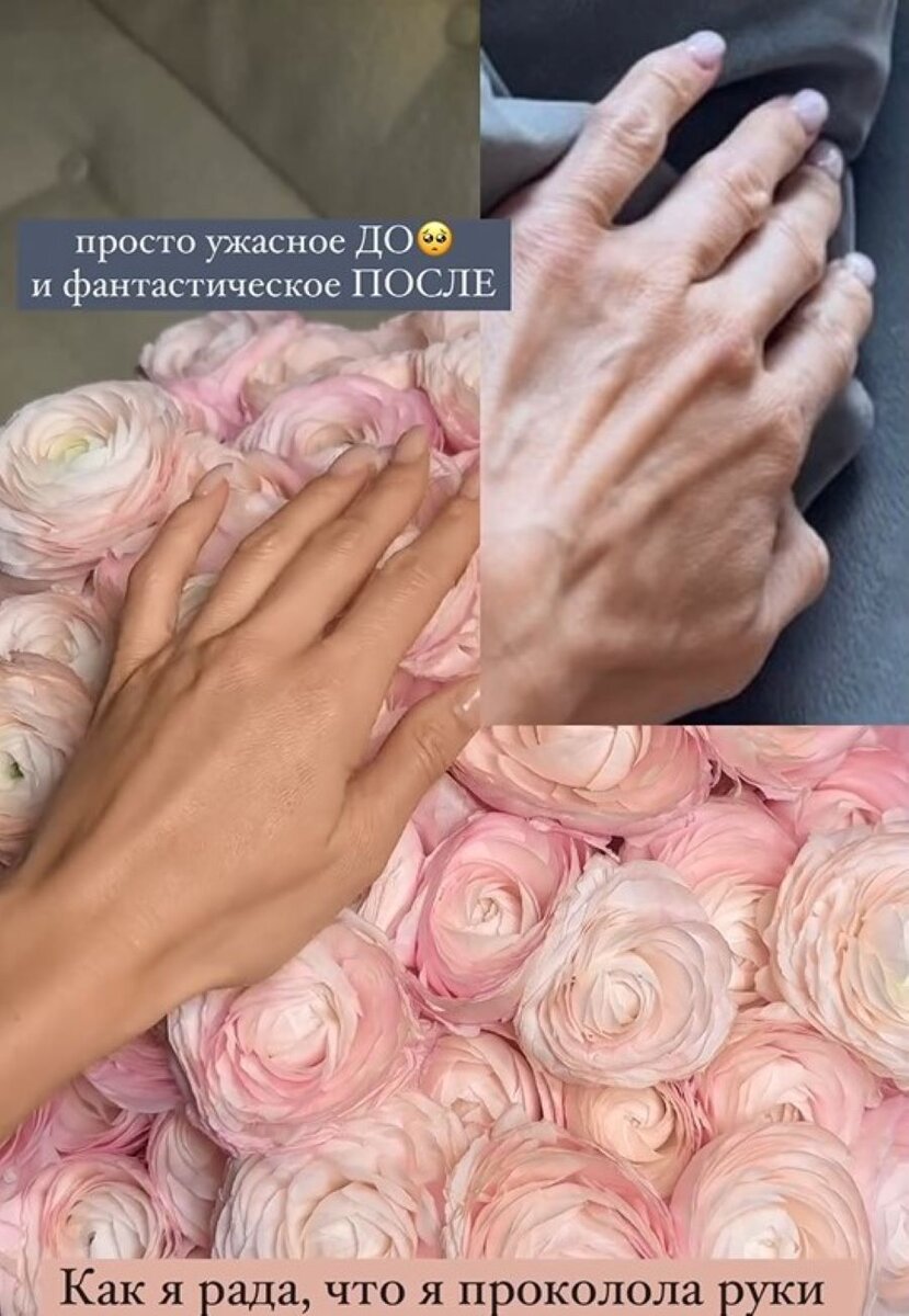 какой компресс после укола