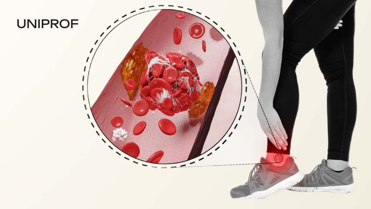 разрушение кровяных пластинок образование тромба