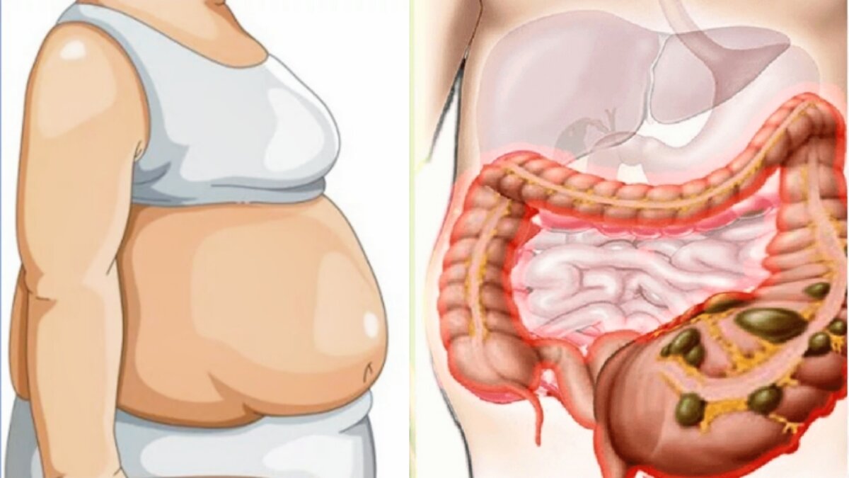 Внешне это выглядит не очень и портит даже хорошую фигуру