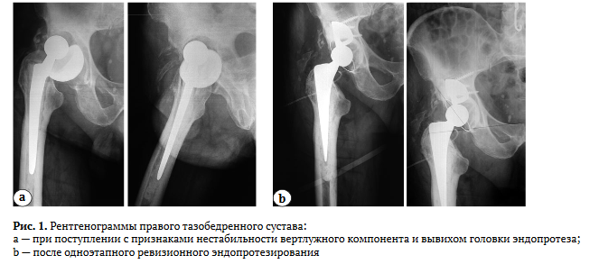 Лита какого числа. Лита какого числа. Колесо года бельтайн йоль. Лита какого числа. Имболк праздник колеса года.