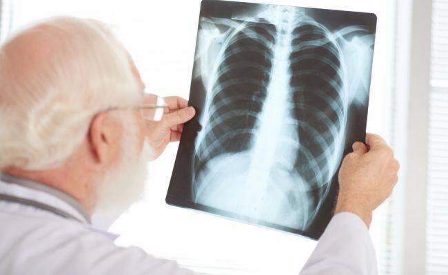 тест микоплазменная пневмония 12 вопросов