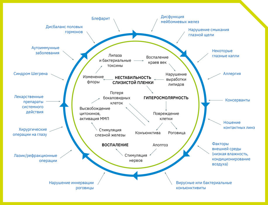 Рисунок. Патогенез развития синдрома сухого глаза: теория «порочного круга»
