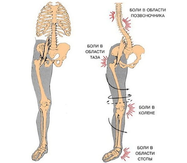 Боль от колена до стопы по передней стенке