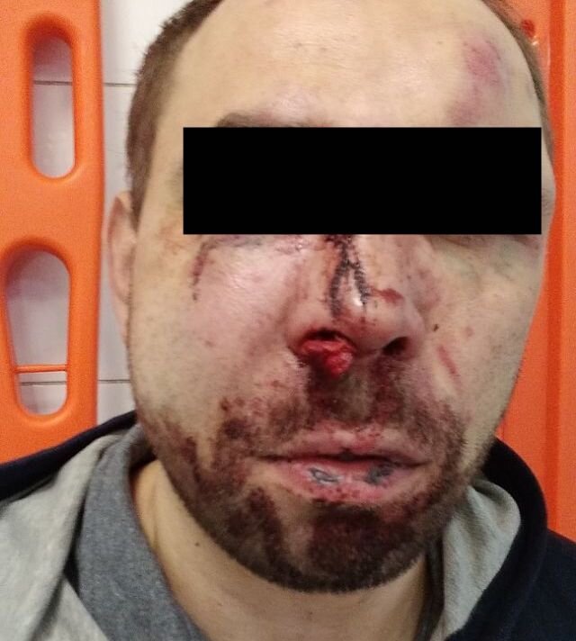    Новый поворот в скандальной межнациональной драке в Иванове