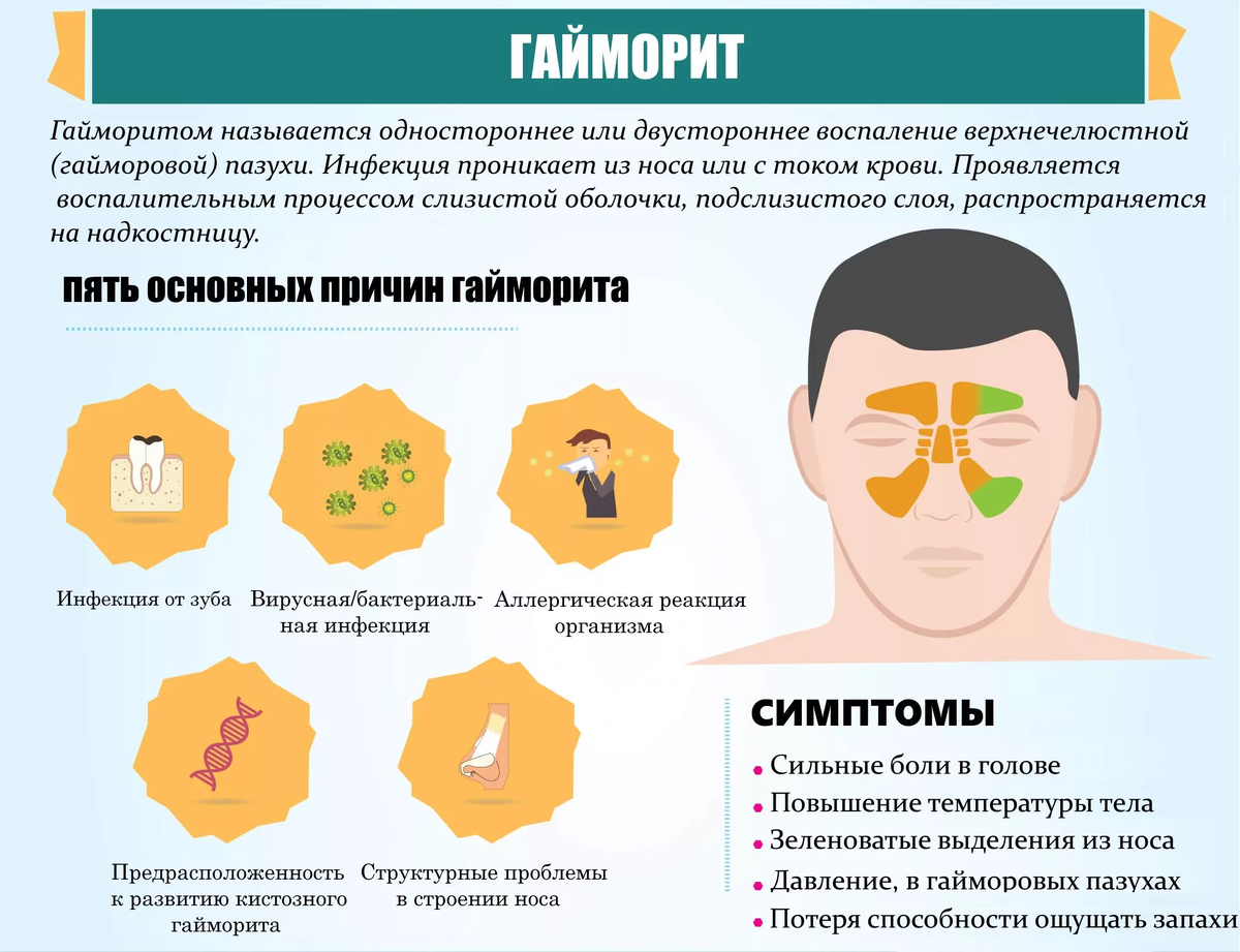 Головная боль заложенность носа сухой кашель. Носовые пазухи гайморит.