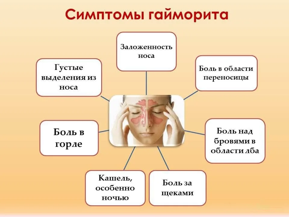 Может ли от носа быть температура