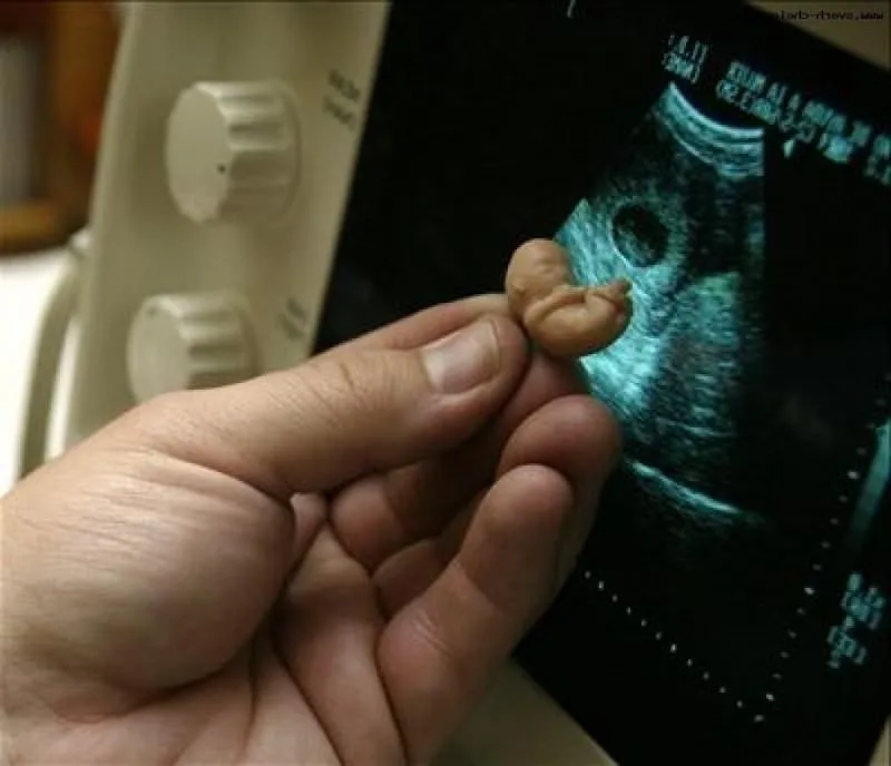 Чувствую что будет мальчик. Плод в 20 недель прерывание. После медикаментозного прерывания. Эмбрион после медикаментозного аборта. Выкидыш на раннем сроке плодное яйцо.