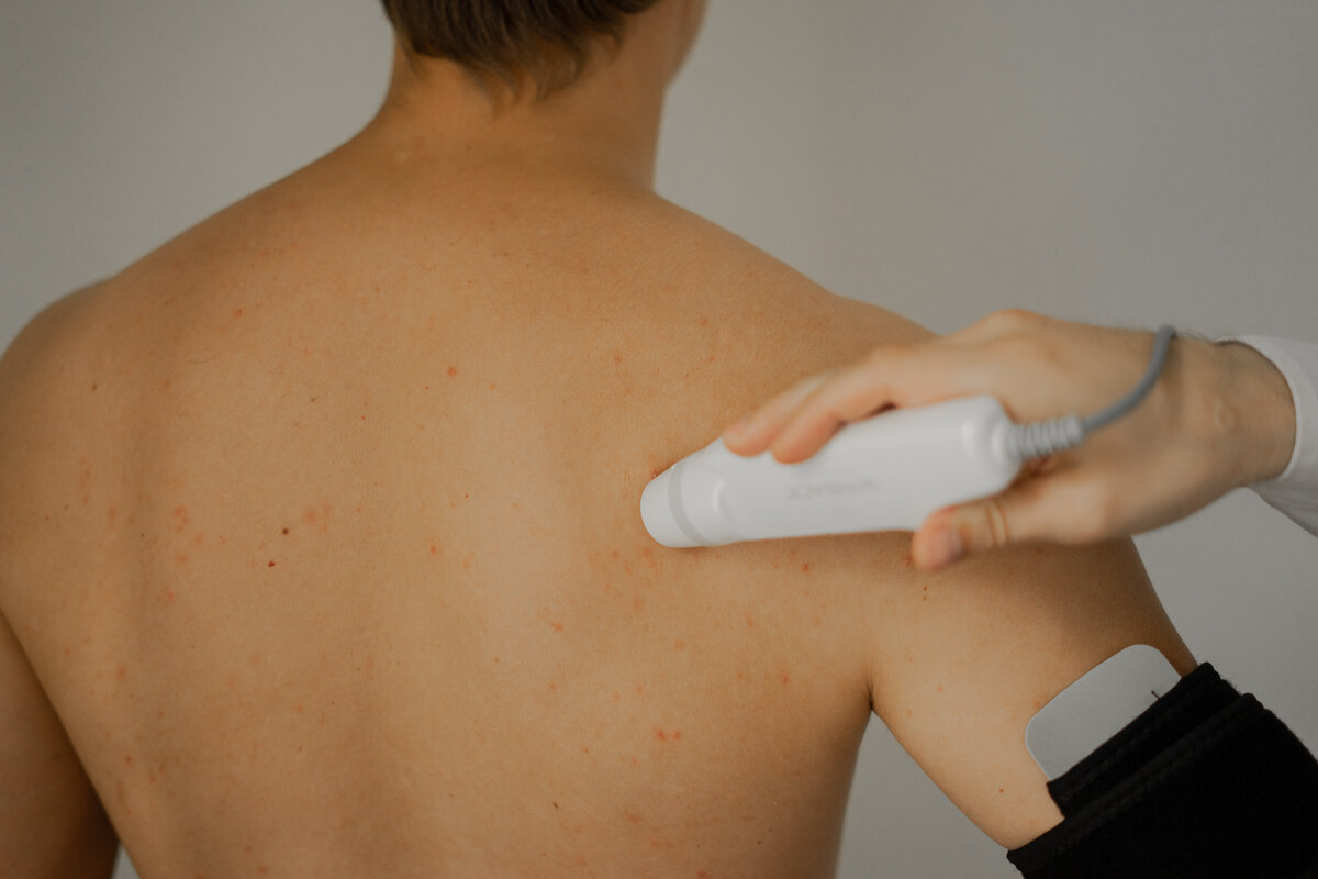 Процедура TECAR-терапии