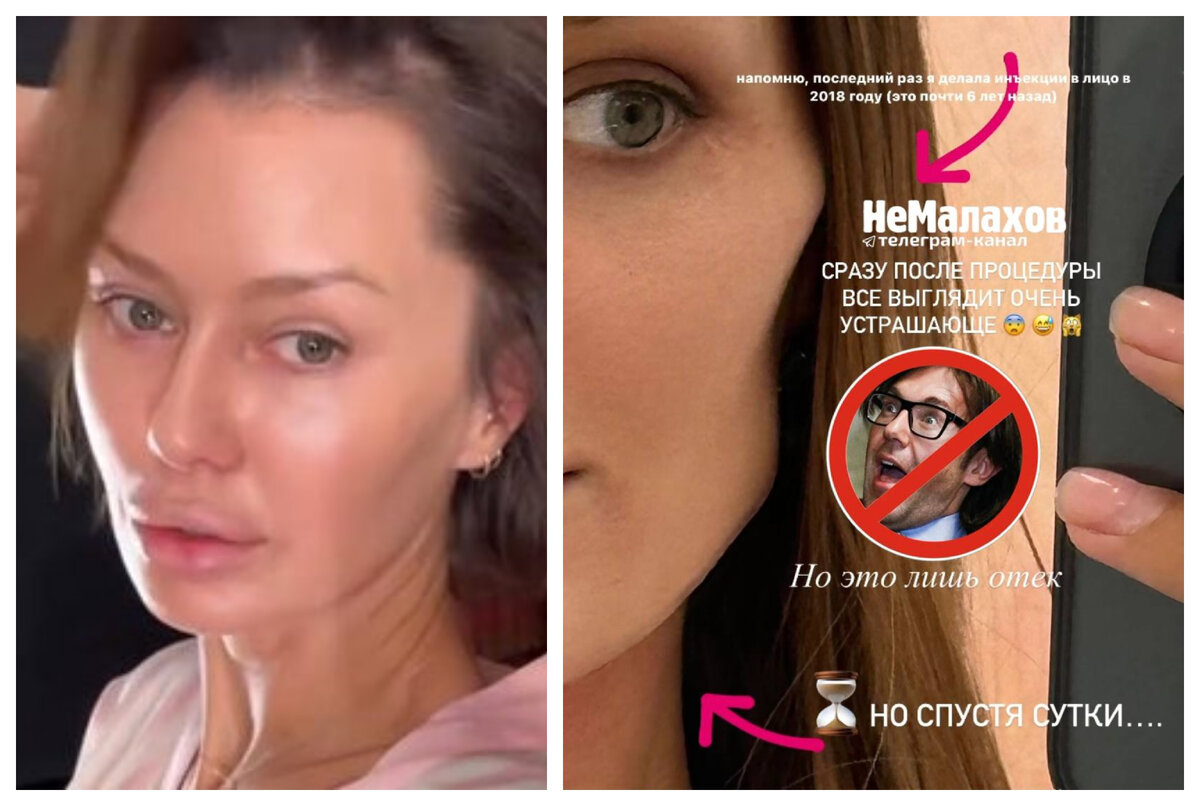 личико что делает.