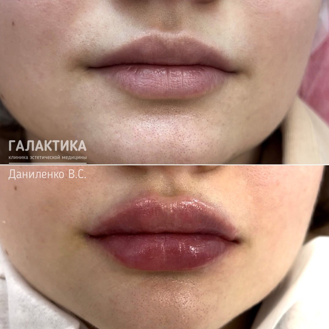 Губы на маленьком лице. Гладкие губы. Красивая форма губ. Губы на маленьком лице. Anais pouliot.