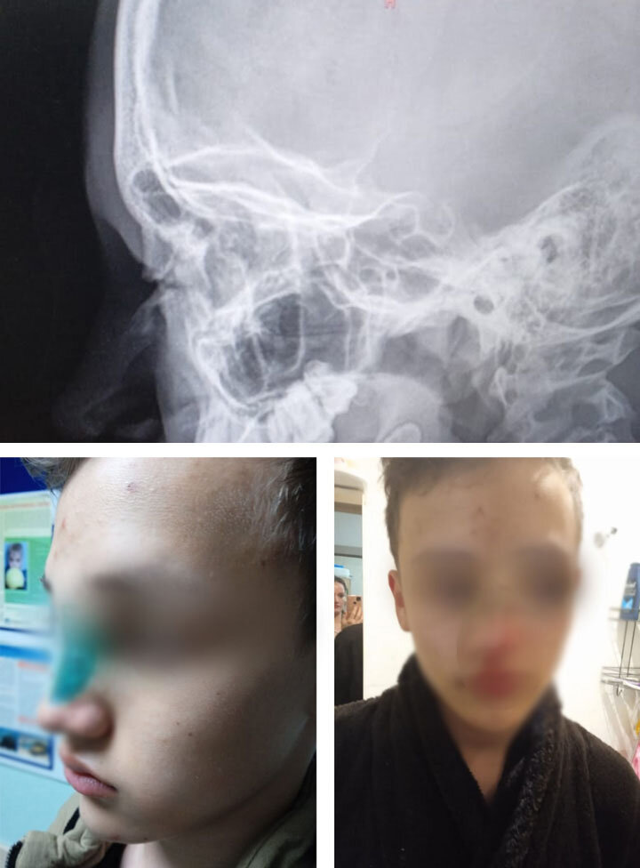 Фото: предоставлено родителями пострадавшего