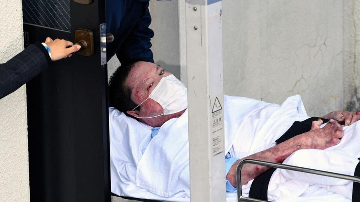    Синдзи Аоба:The Asahi Shimbun/Getty Images