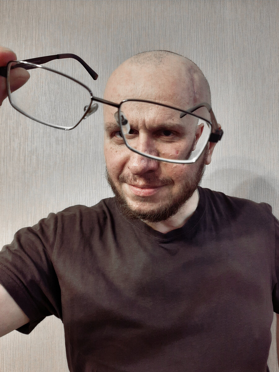 РАК МОЗГА. АФАЗИЯ. МРТ головного мозга с контрастом. Уточнили по ...