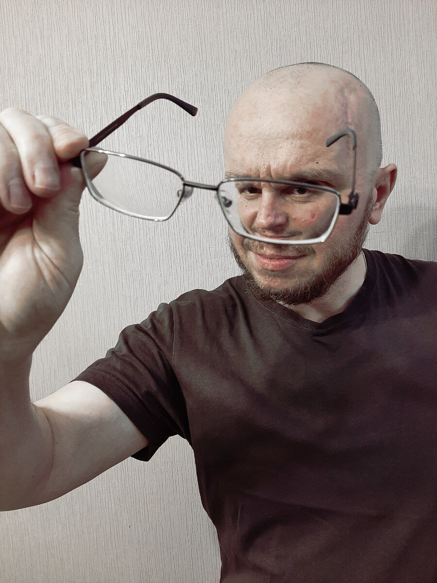 РАК МОЗГА. АФАЗИЯ. МРТ головного мозга с контрастом. Уточнили по ...