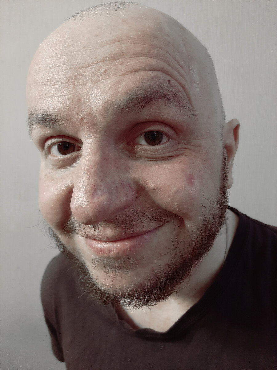 РАК МОЗГА. АФАЗИЯ. МРТ головного мозга с контрастом. Уточнили по ...