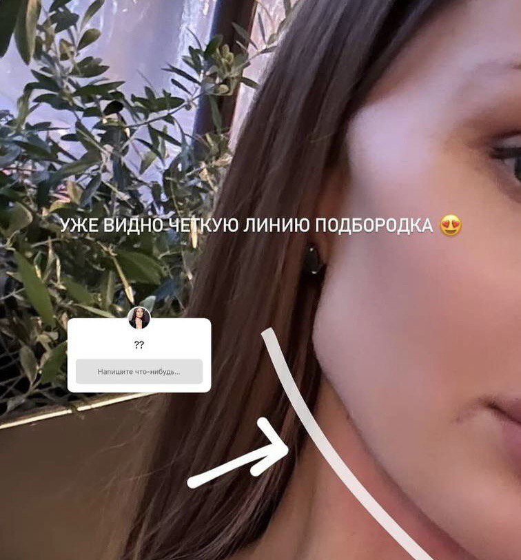 Лекарство для блокады позвоночника дипроспан. Укол один раз год. Уколы от аллергии. Дипроспан укол 1мл. Сколько можно колоть дипроспан внутримышечно.