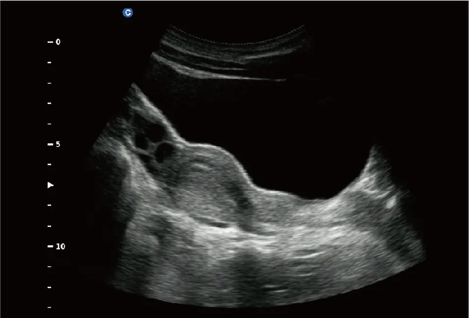 узи почек у детей норма