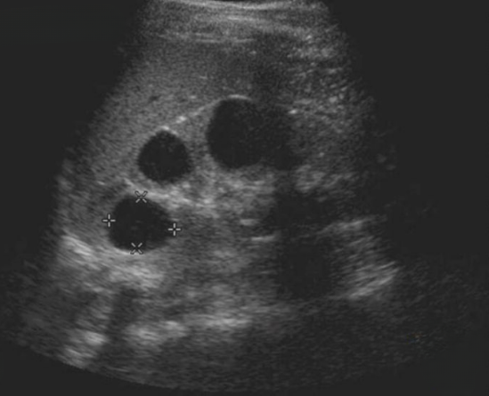 узи почек рекомендации. как нужно подготовиться к узи почек. узи почек алгоритм подготовки к исследованию. подготовка больного к ультразвуковому исследованию почек. подготовка к узи почек памятка.