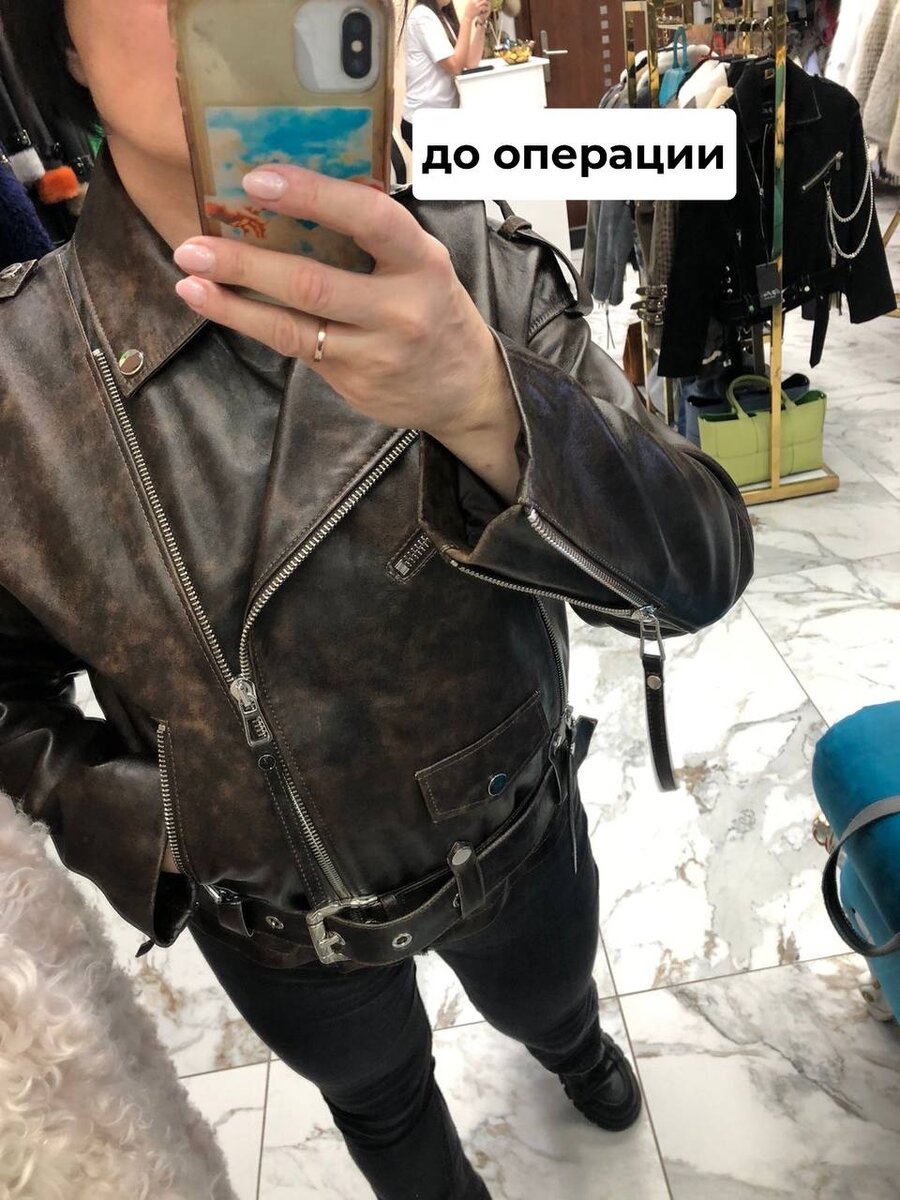 На фото пациентка Данилы Лупина. Имеются противопоказания, необходима консультация специалиста.