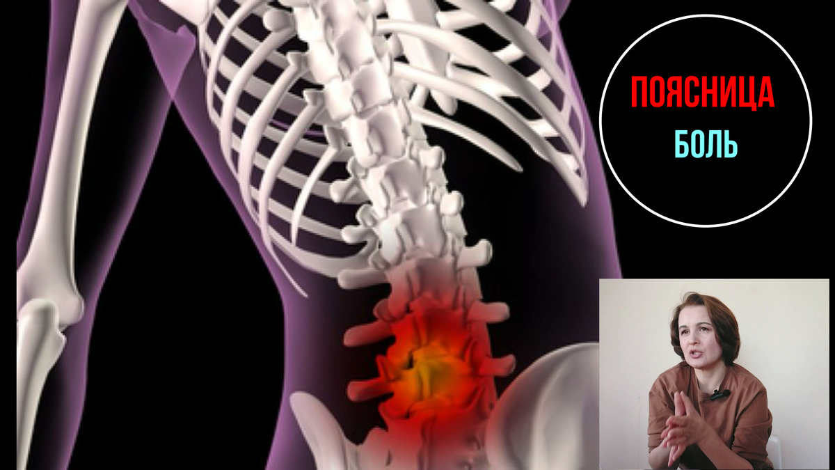 люмбаго в пояснице. болит спина картинки. боль в пояснице. ломит поясницу форум. почему болит поясница.