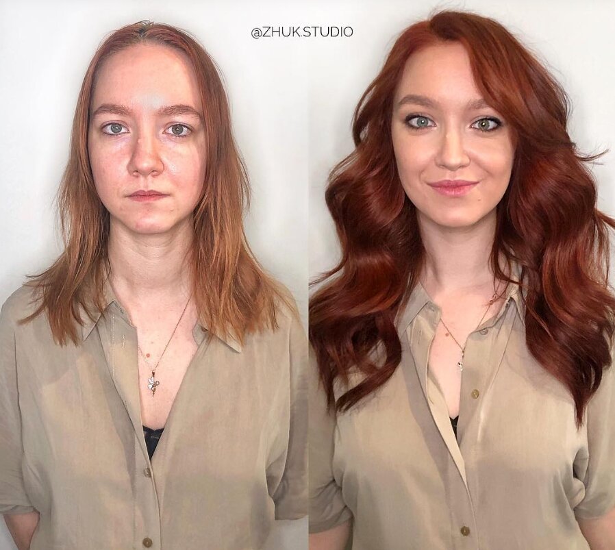 канал пластический хирург. канал пластический хирург. канал пластический хирург. канал пластический хирург. реконструктивная маммопластика.