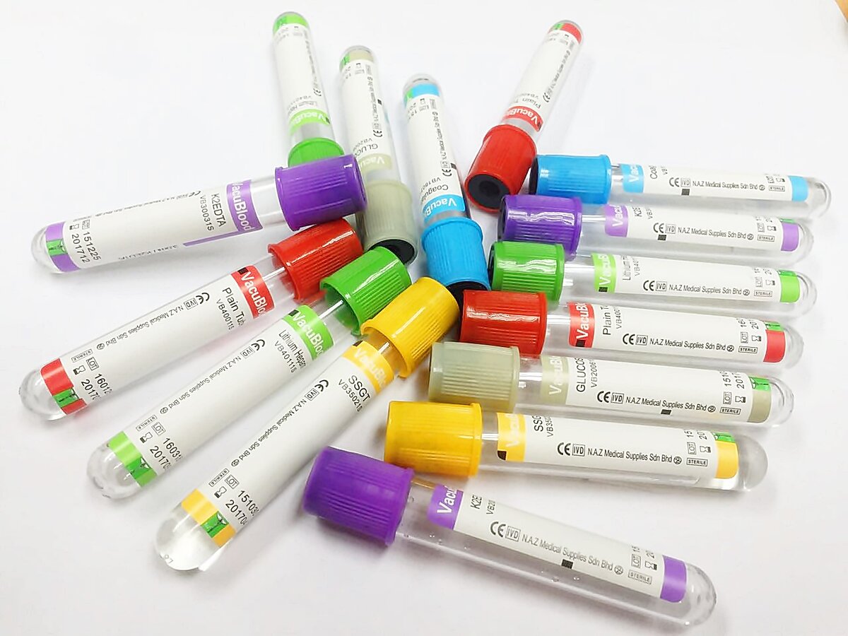 Примерно такое количество пробирок сдает ревматологический пациент каждые 2 недели.