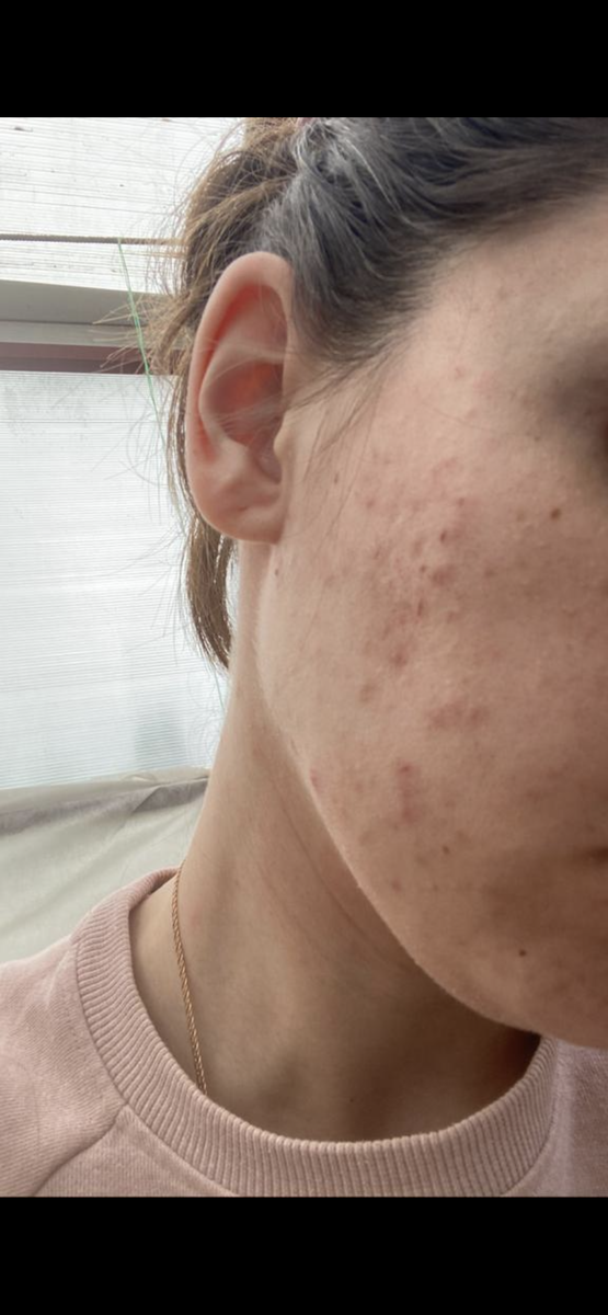 И так и ещё много как😄