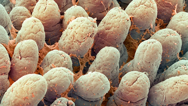 Выстилка тонкой кишки содержит пальцеобразные структуры, которые помогают всасывать питательные вещества и жидкость.Фото: Steve Gschmeissner/Science Photo Library via Alamy