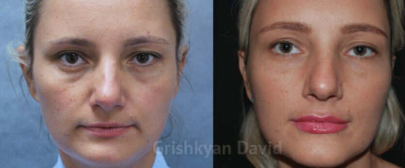 век хирургов