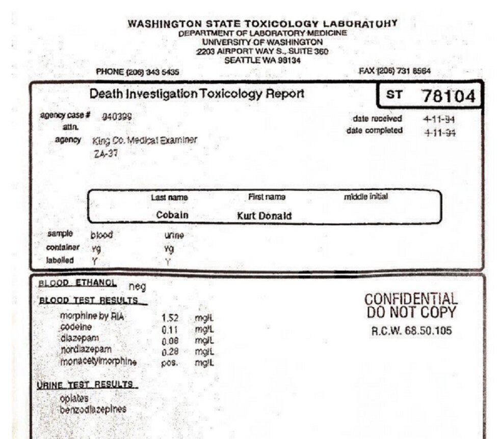    Отчет о вскрытии Курта Кобейна опубликовали в СетиTMZ