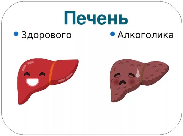 Как выглядит печень пьющего человека