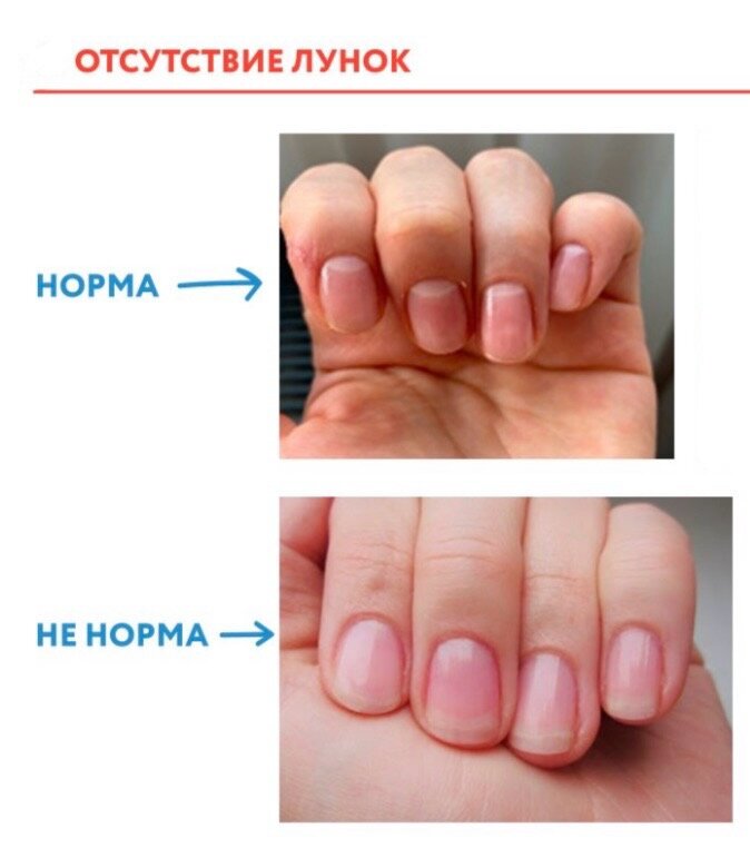 Ногти человека являются. Плакат строение ногтя для маникюра. Строение ногтевой пластины анатомия. Строение ногтевой пластины матрикс. Строение ногтя и ногтевой пластины анатомия.