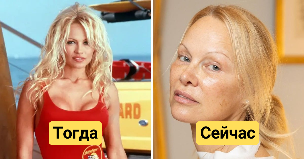 Как изменились 15 актёров культового сериала «Спасатели Малибу», первая ...