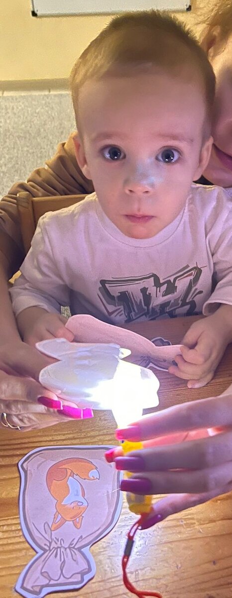 Начальный пульпит гиперемия. Лечение корнями детей. Лечение пульпита постоянных несформированных зубов. Лечение корнями детей. Морфологические особенности ребенка.