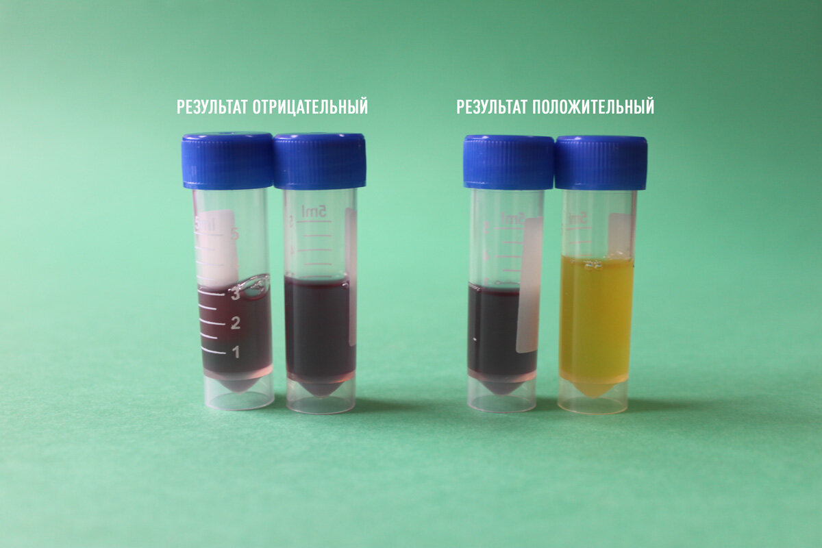 Несогласованное определение выраженное инфинитивом. Кластер на тему геометрические фигуры. Обособленные несогласованные определения. Несколько распространенных определений соединенных союзом. Без определений.